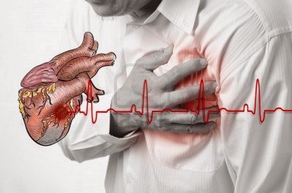 Mengobati penyakit jantung